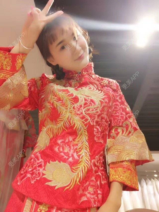 雨梦迟歌的自体脂肪填充面部