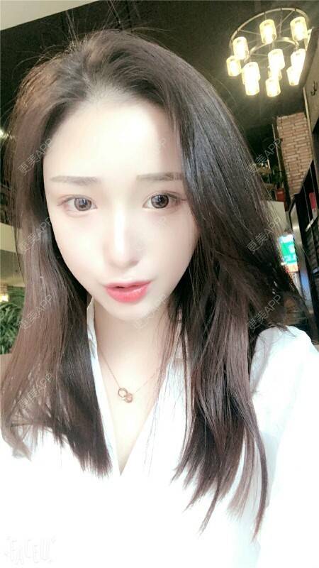 更美 - 琉璃暗影的经验 | 还好整了它 | 自体耳软骨垫鼻尖 | 武汉