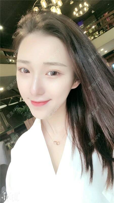 更美 - 琉璃暗影的经验 | 还好整了它 | 自体耳软骨垫鼻尖 | 武汉