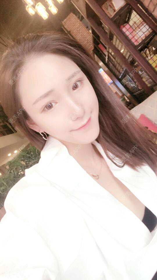 更美 - 琉璃暗影的经验 | 还好整了它 | 自体耳软骨垫鼻尖 | 武汉