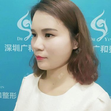 黄丽华 医生