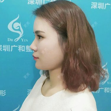 黄丽华 医生