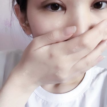 。