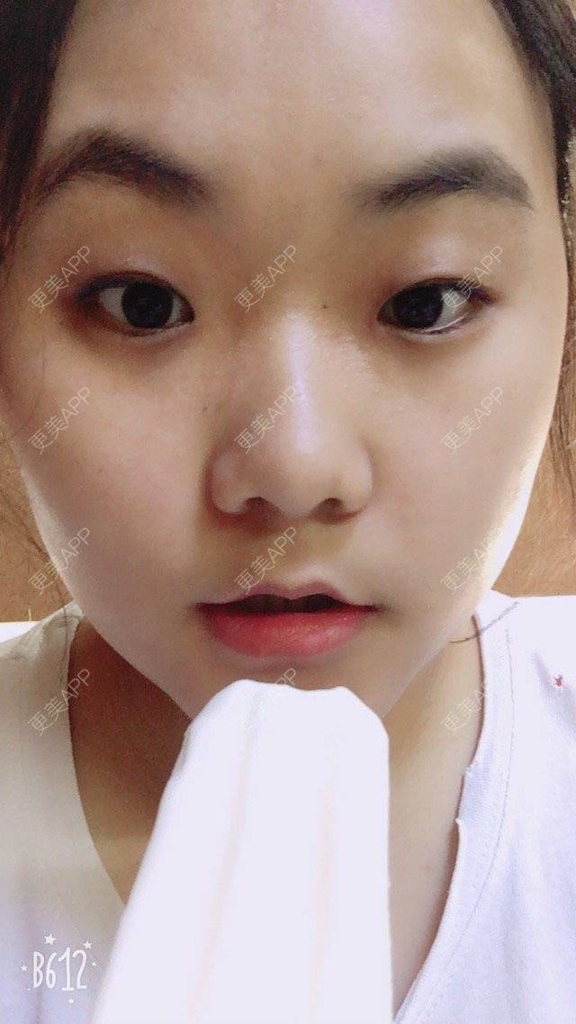 更美 - 一天的时间的经验 | 脸部轮廓 | 武汉