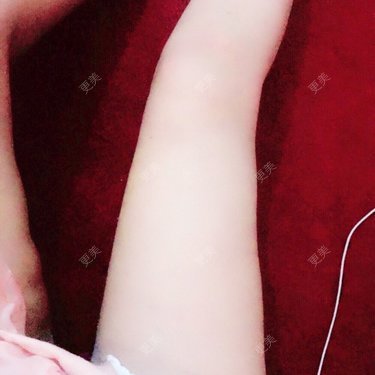 zoeiii