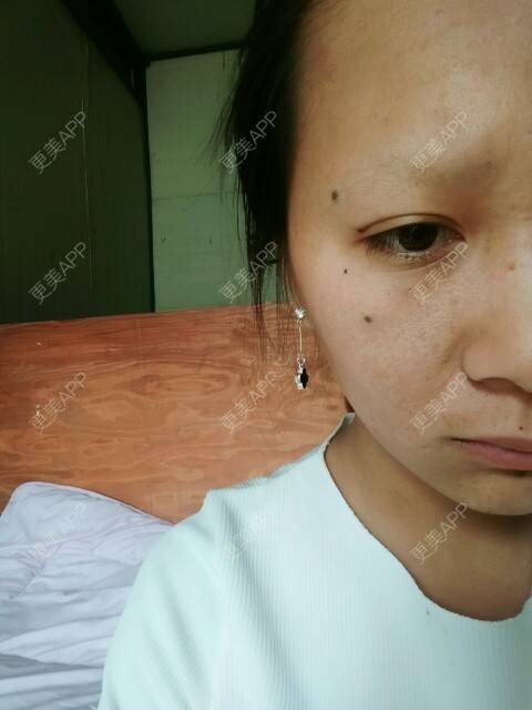 更美 - 罗恩龙的小娇妻🍃的经验 | 脸部毛孔粗大 | 南京