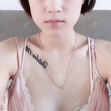 下颌角
