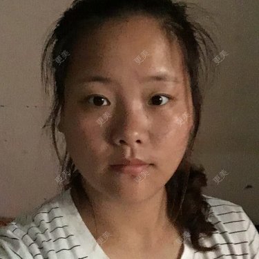 注射美容