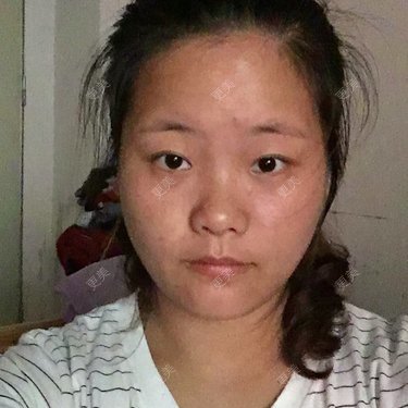 注射美容
