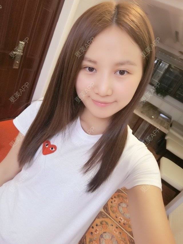 更美 - 吃鱼缸的经验 | 臀部吸脂手术 | 吸脂脸颊 | 下面部吸脂 | 南昌