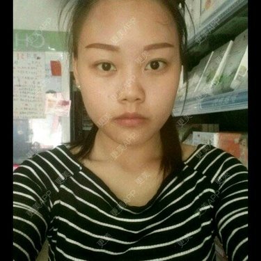 面部轮廓