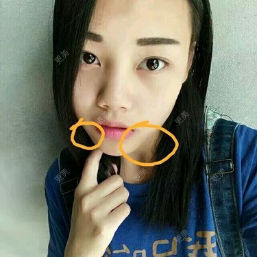 下巴