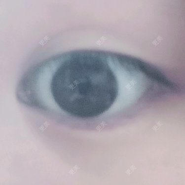 眼部整形