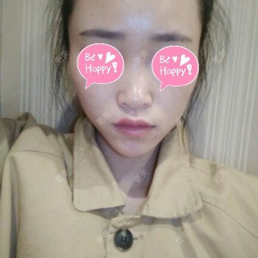 鼻部整形