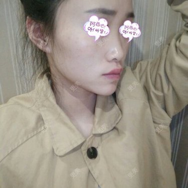 鼻部整形