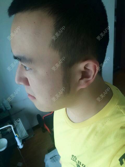 更美 - 王涛 医生的经验 | 成都