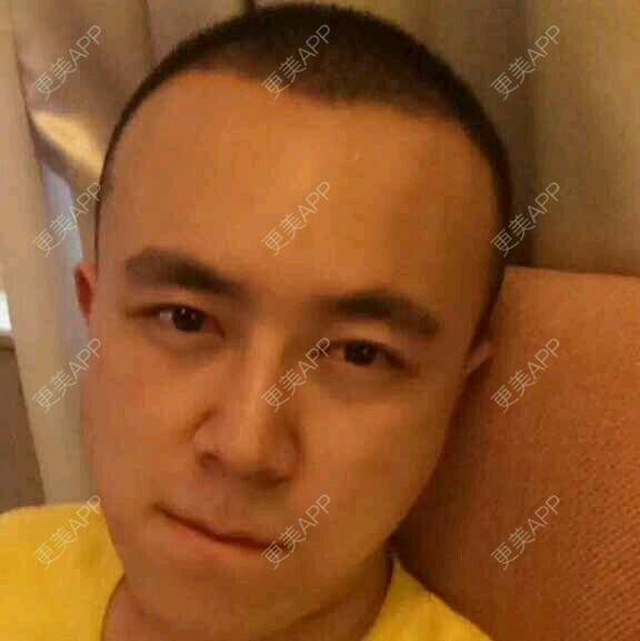 更美 - 王涛 医生的经验 | 成都