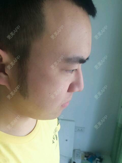更美 - 王涛 医生的经验 | 成都