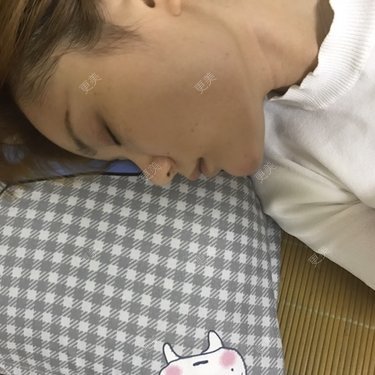 注射美容