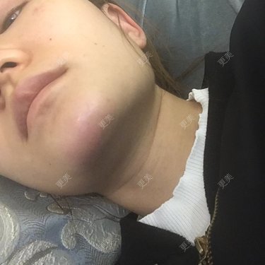 注射美容