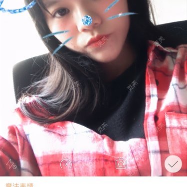 鼻部整形