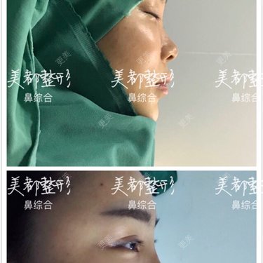 张召 医生