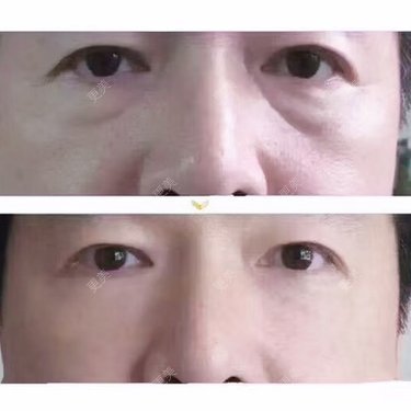 张召 医生