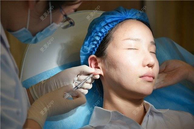 米宝宝92的玻尿酸耳垂日记