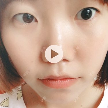 哪家W菇娘
