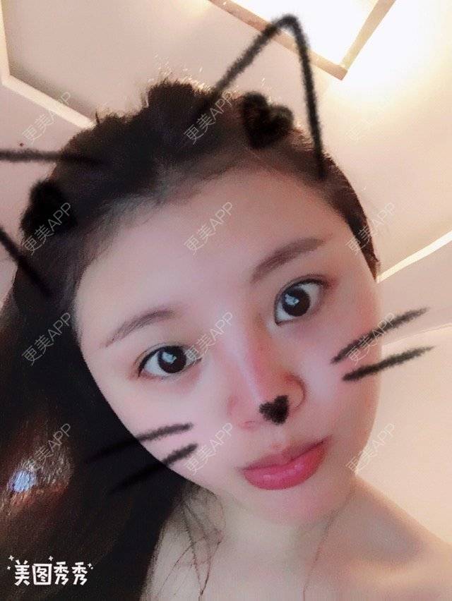 更美 - ❤️心嗳的经验 | 注射美容 | 鼻部整形 | 常州
