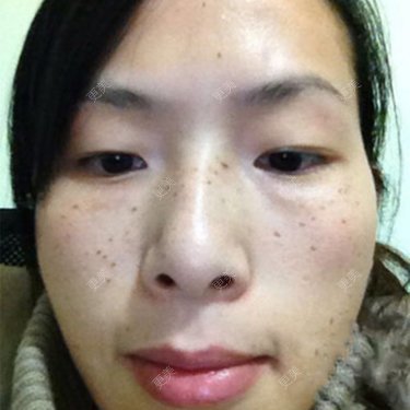 艾美儿233