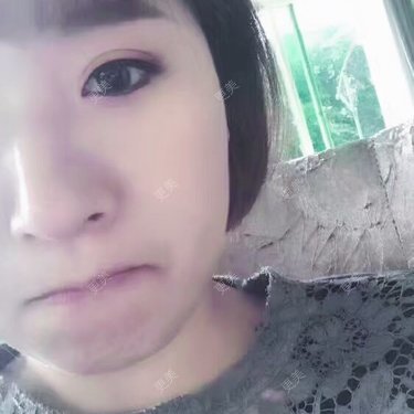 张召 医生