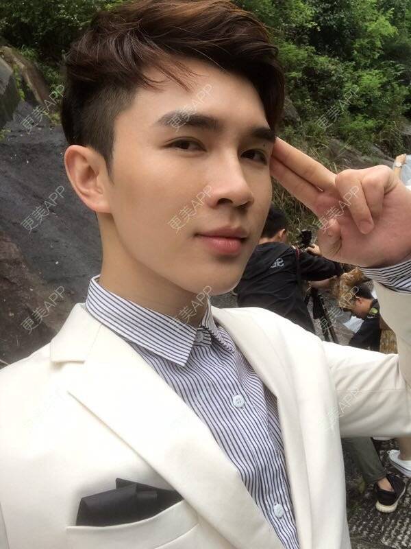 更美 - 笑笑笑水阁的玻尿酸额头经验 | 玻尿酸额头 | 长沙