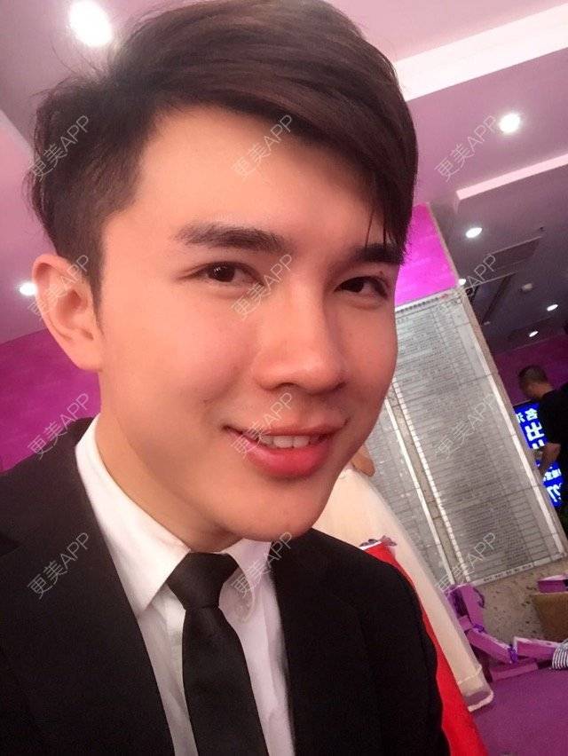 更美 - 笑笑笑水阁的玻尿酸额头经验 | 玻尿酸额头 | 长沙