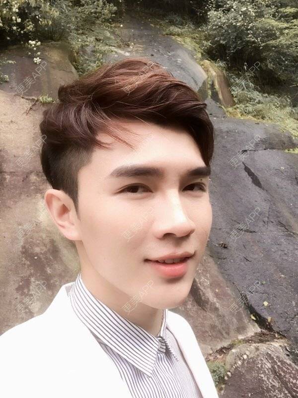 更美 - 笑笑笑水阁的玻尿酸额头经验 | 玻尿酸额头 | 长沙