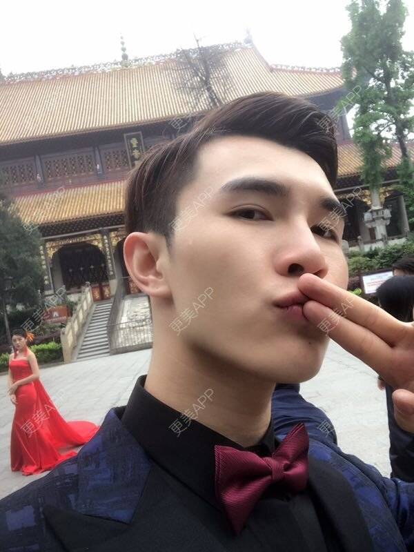 更美 - 笑笑笑水阁的玻尿酸额头经验 | 玻尿酸额头 | 长沙