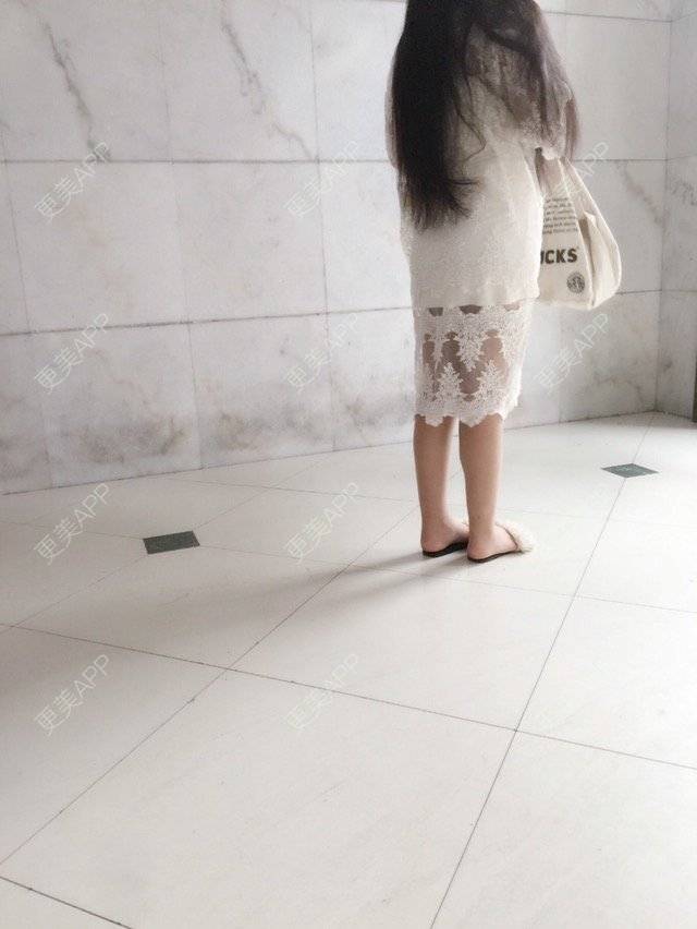 更美 - 慢漫曼小姐的吸脂瘦大腿经验 | 宁波 | 吸脂瘦大腿