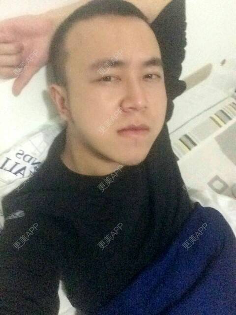 更美 - 王涛 医生的经验 | 耳发 | 鬓角植发 | 成都