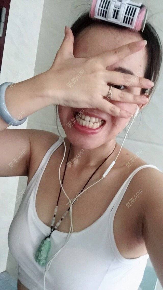 更美 - BB喜的经验 | 正颌术 | 牙齿正畸 | 地包天 | 深圳