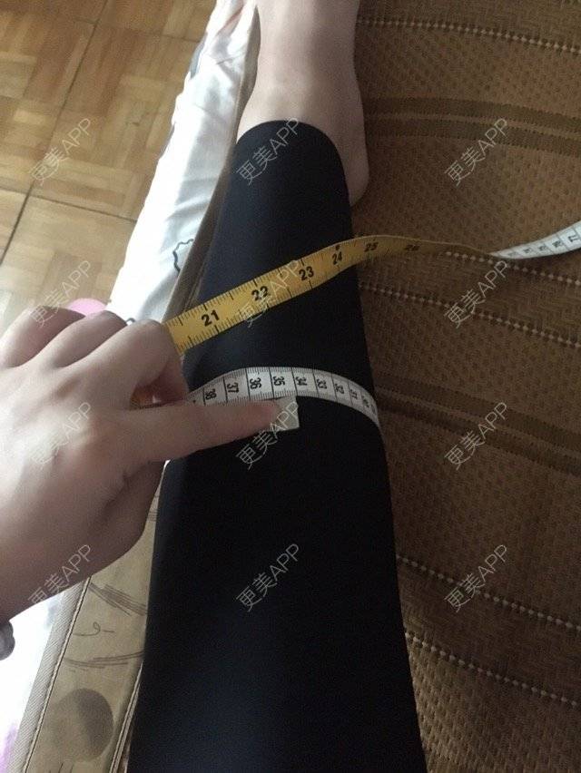 更美 - 大ci小ci的吸脂瘦大腿经验 | 成都 | 吸脂小腿 | 吸脂瘦大腿