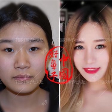 杜太超 医生