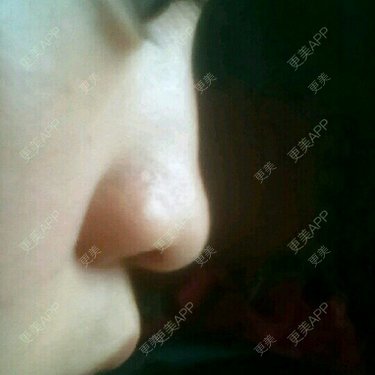 更美用户7984508725