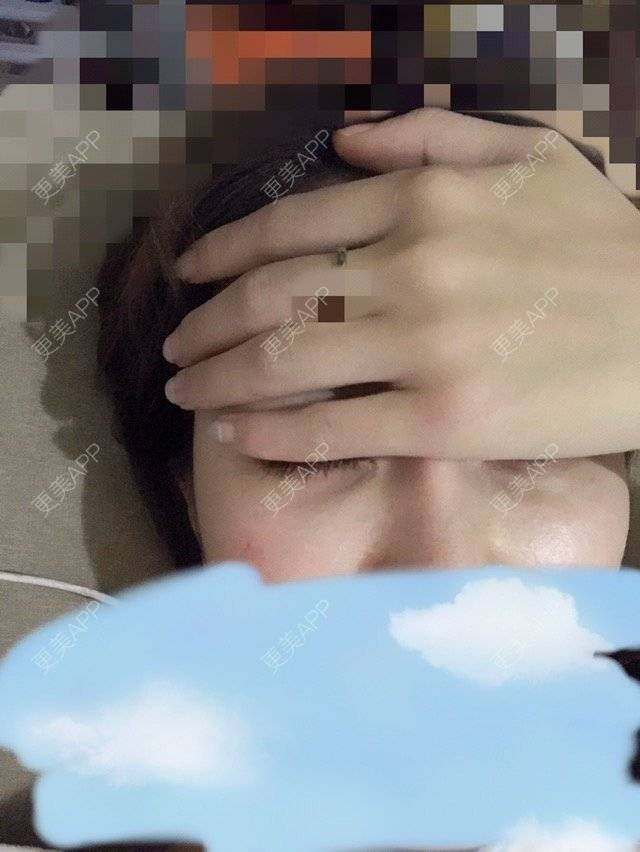 更美 - 更美用户lJ67VJM3Hv的经验 | 注射美容 | 童颜针 | 成都