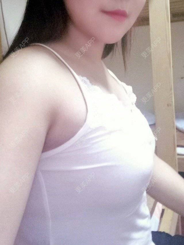 更美 - 我想你爱我的自体脂肪隆胸经验 | 自体脂肪隆胸 | 丰胸（隆胸） | 隆胸 | 重庆