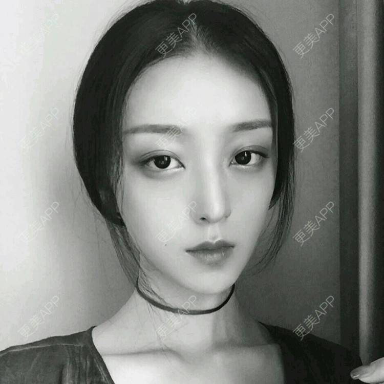 更美 - 鱼隔的经验 | v脸 | 瘦脸类 | 潮州
