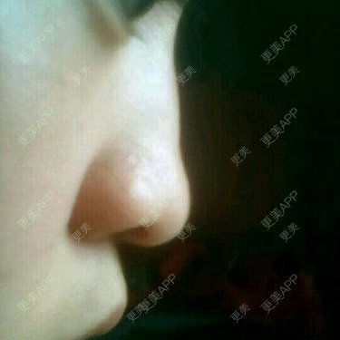 更美用户7984508725