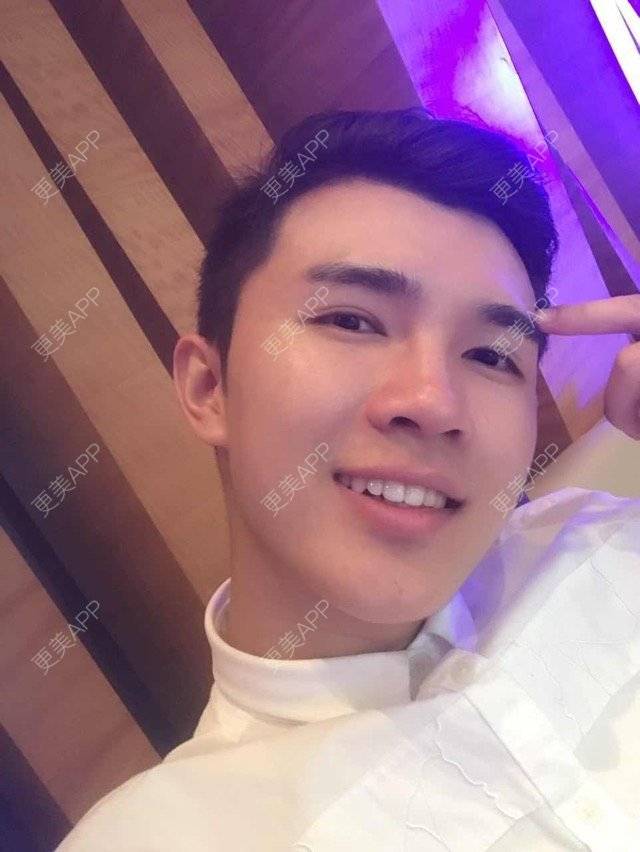 更美 - 笑笑笑水阁的玻尿酸额头经验 | 玻尿酸额头 | 长沙