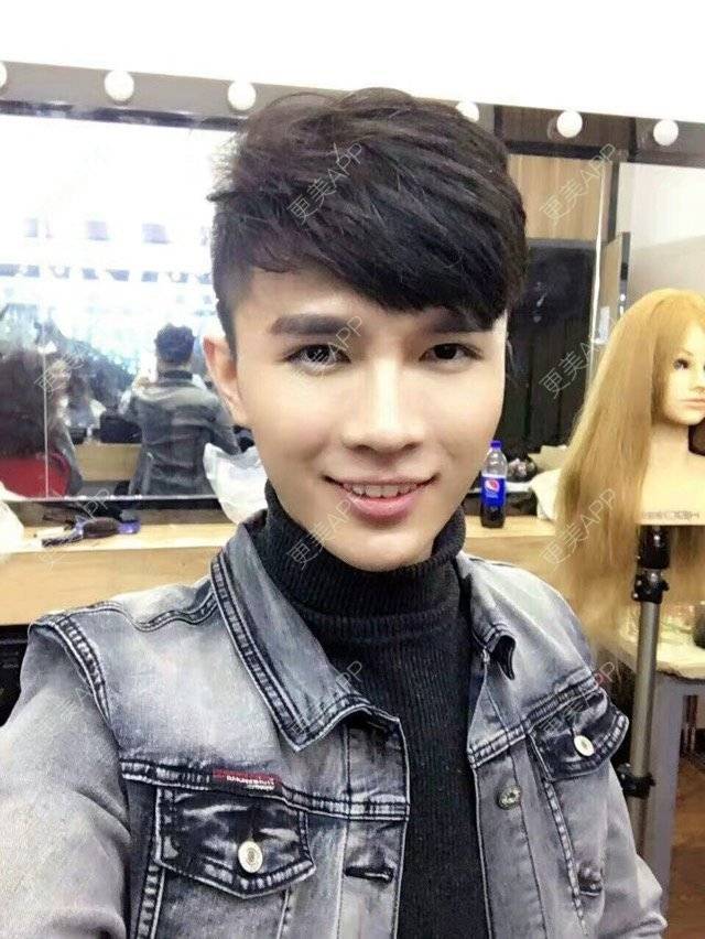 更美 - 笑笑笑水阁的玻尿酸额头经验 | 玻尿酸额头 | 长沙