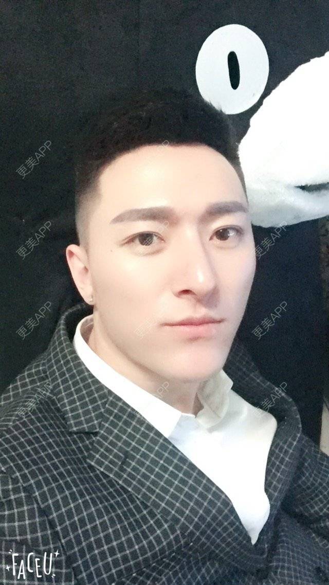 更美 - 柳安花明又一村的玻尿酸额头经验 | 长沙 | 玻尿酸额头