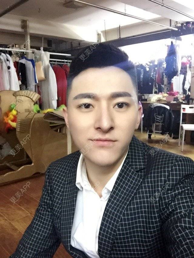 更美 - 柳安花明又一村的玻尿酸额头经验 | 长沙 | 玻尿酸额头